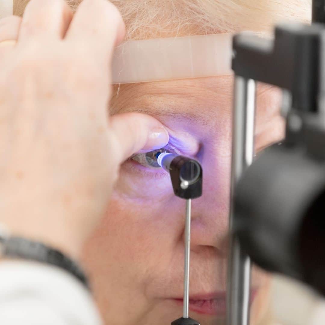 what are the symptoms of cataracts and glaucoma