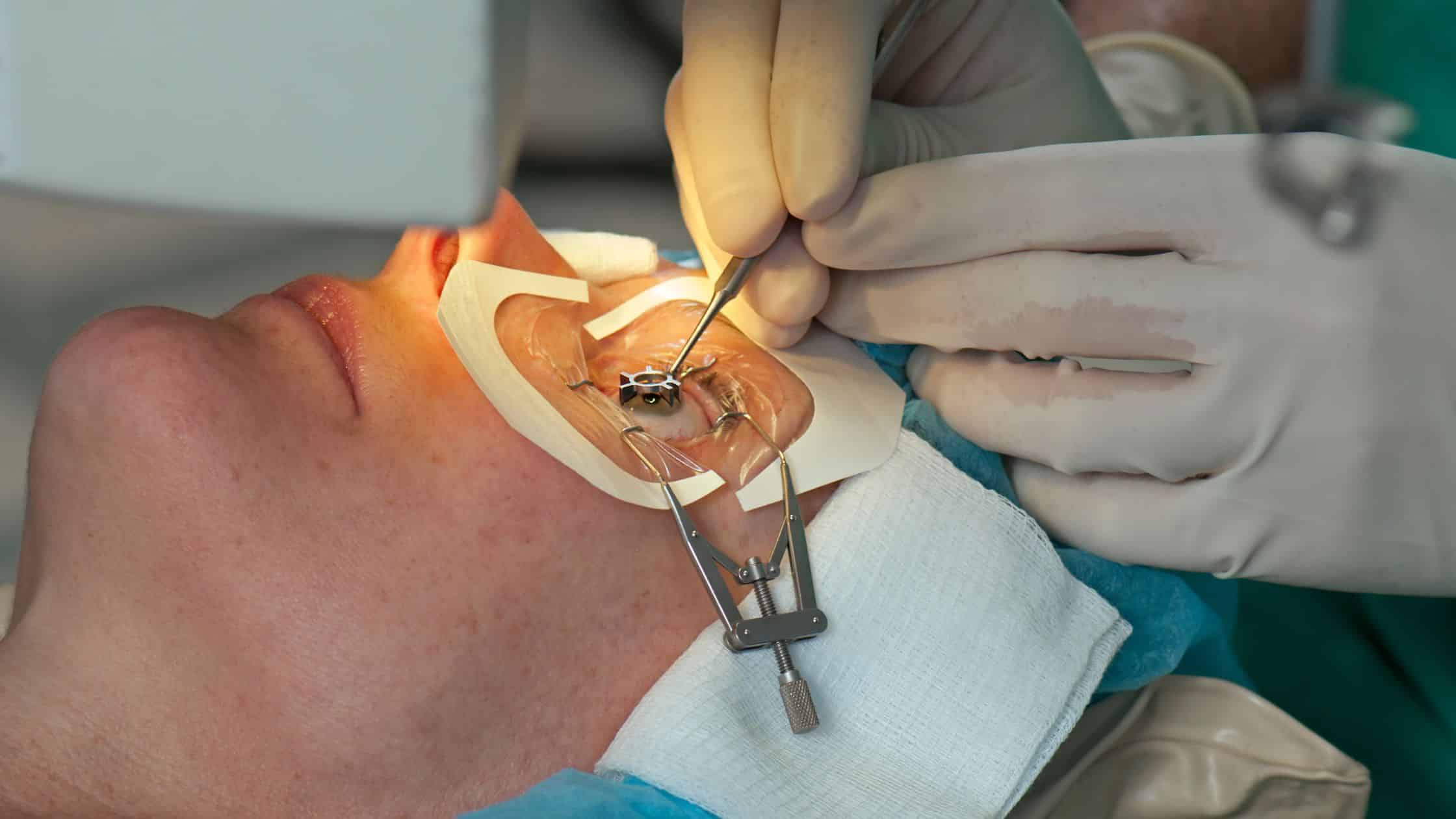 Dollars and Sense Unveiling the True Cost of LASIK in Texas Texas Vision and Laser Center