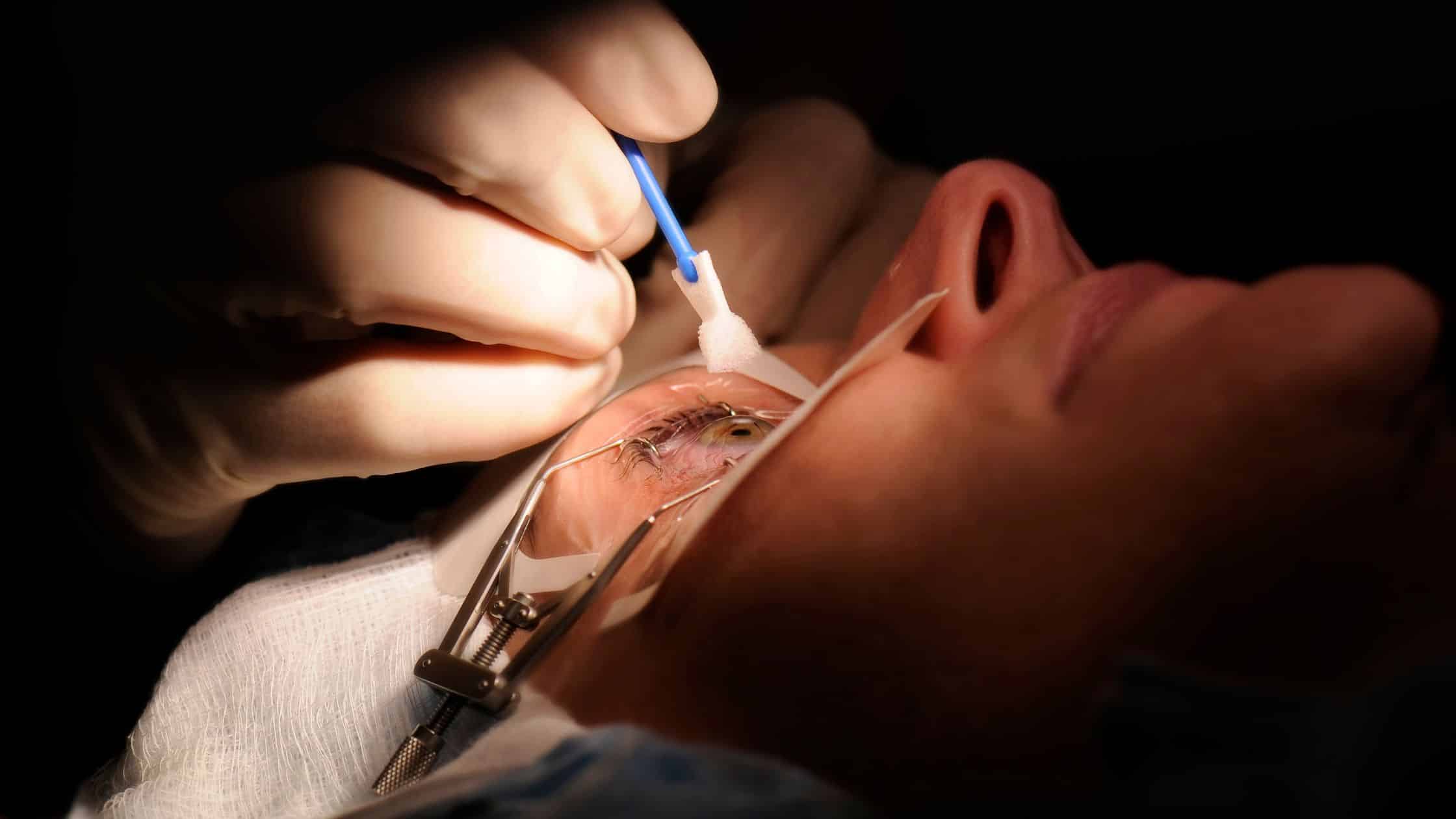 how much does lasik cost for astigmatism