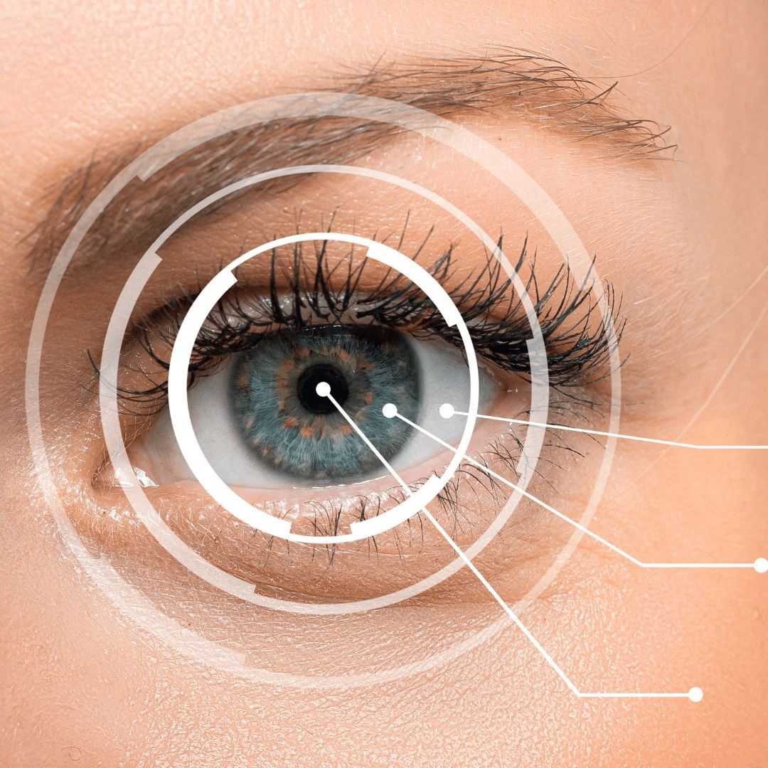 Understanding the LongTerm Impacts of LASIK Eye Surgery