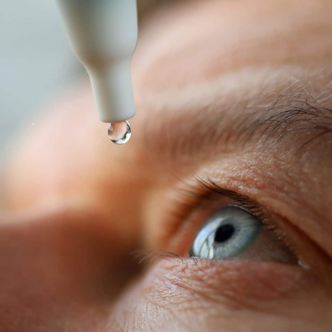 Choosing the Best Eye Drops After Lasik Surgery Texas Vision and